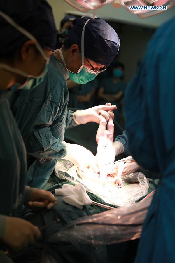 CHINA-SHAANXI-XI'AN-TRANSPLANTED WOMB-BABY-BIRTH (CN)